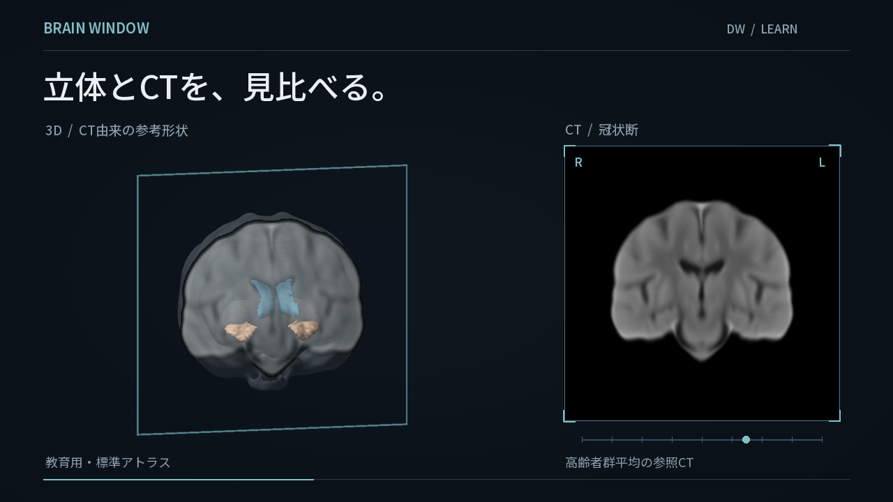 BRAIN WINDOWの紹介。回転する脳の参考形状と対応するCT断面